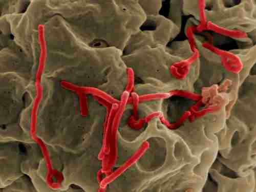 The Ebola virus (Science Insider)
