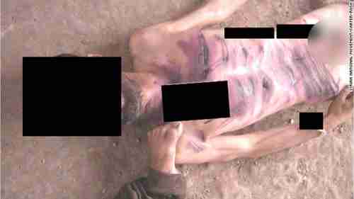 Emaciated man showing wounds from repeated beatings by rod-like object.  There are 55,000 photos like this, showing 11,000 corpses