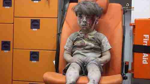 Five year old boy, Omran Daqneesh, sitting confused in an ambulance in Aleppo after being pulled from the rubble of one of Bashar al-Assad's airstrikes.  To al-Assad, this boy and others like him are just cockroaches to be exterminated.