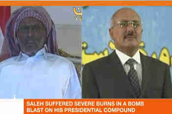 Ali Abdullah Saleh before (right) and after (Al-Jazeera)
